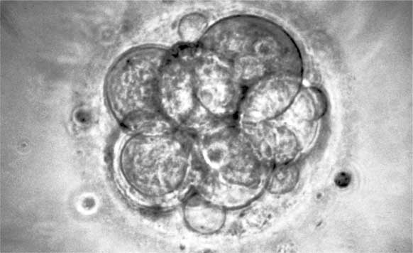 Иллюстрация к книге — Метаморфозы. Путешествие хирурга по самым прекрасным и ужасным изменениям человеческого тела [i_004.jpg]