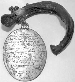 Иллюстрация к книге — Метаморфозы. Путешествие хирурга по самым прекрасным и ужасным изменениям человеческого тела [i_007.jpg]