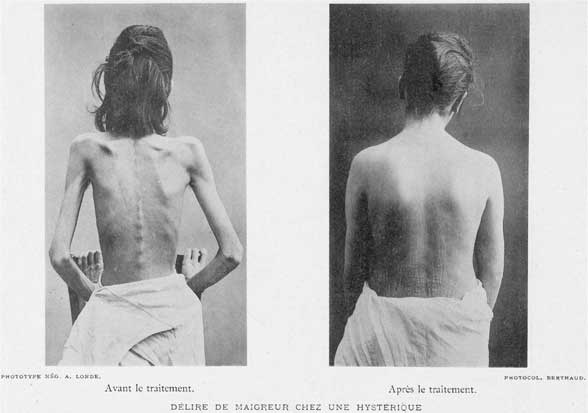 Иллюстрация к книге — Метаморфозы. Путешествие хирурга по самым прекрасным и ужасным изменениям человеческого тела [i_013.jpg]