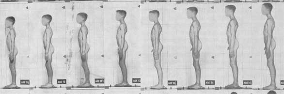 Иллюстрация к книге — Метаморфозы. Путешествие хирурга по самым прекрасным и ужасным изменениям человеческого тела [i_016.jpg]