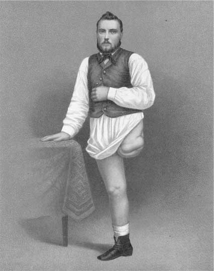 Иллюстрация к книге — Метаморфозы. Путешествие хирурга по самым прекрасным и ужасным изменениям человеческого тела [i_028.jpg]