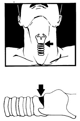 Иллюстрация к книге — Выживание везде и всегда [i_437.jpg]