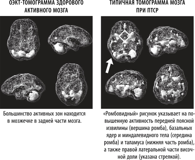 Иллюстрация к книге — Полюби свой мозг [i_027.jpg]