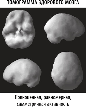 Иллюстрация к книге — Полюби свой мозг [i_041.jpg]