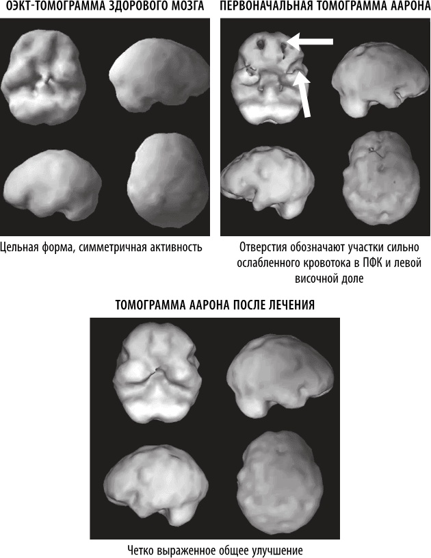 Иллюстрация к книге — Полюби свой мозг [i_049.jpg]