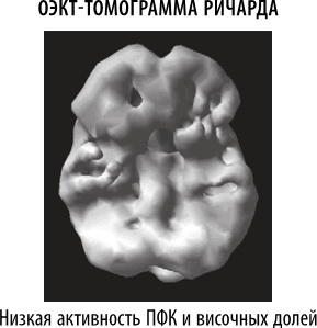 Иллюстрация к книге — Полюби свой мозг [i_052.jpg]