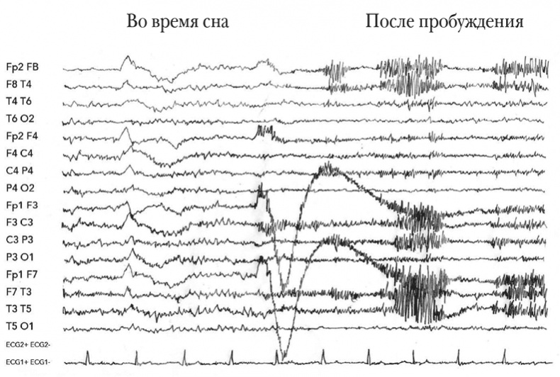 Иллюстрация к книге — Мозговой штурм. Детективные истории из мира неврологии [i_003.jpg]