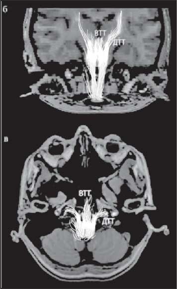 Иллюстрация к книге — Мозг. Как он устроен и что с ним делать [i_012.jpg]