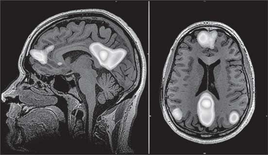 Иллюстрация к книге — Мозг. Как он устроен и что с ним делать [i_040.jpg]