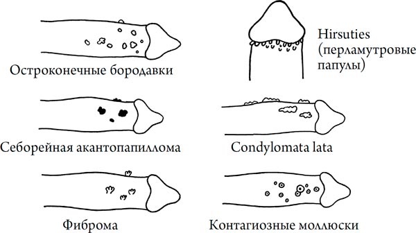 Иллюстрация к книге — Человек Противный [i_120.jpg]