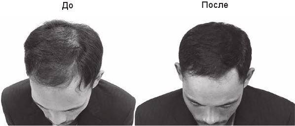 Иллюстрация к книге — Код убеждения. Как нейромаркетинг повышает продажи, эффективность рекламных кампаний и конверсию сайта [i_099.jpg]