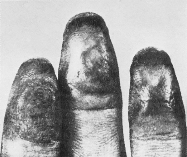 Иллюстрация к книге — Век криминалистики [i_040.jpg]