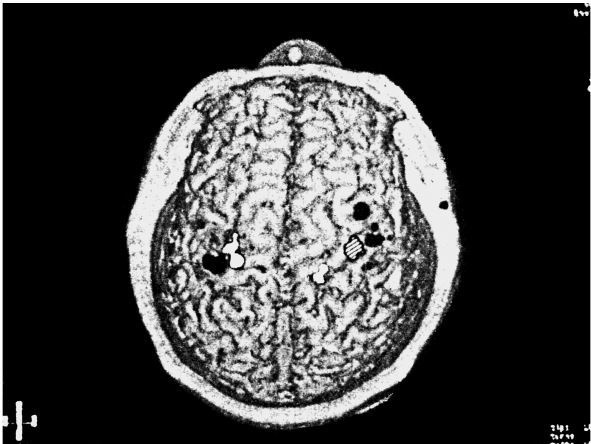 Иллюстрация к книге — Фантомы мозга [i_006.jpg]