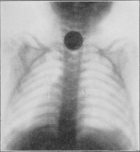 Иллюстрация к книге — Путь избавления. Школа странных детей [i_038.jpg]