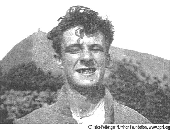 Иллюстрация к книге — Естественное лечение кариеса. Реминерализация и восстановление зубов при помощи питания [i_007.jpg]