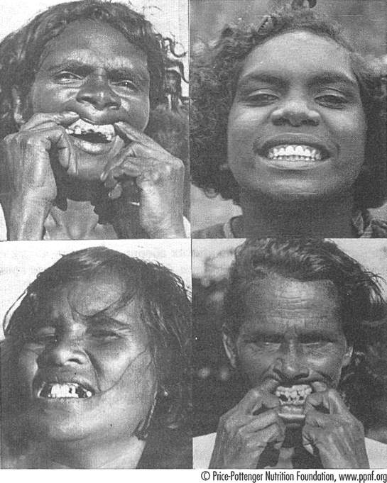 Иллюстрация к книге — Естественное лечение кариеса. Реминерализация и восстановление зубов при помощи питания [i_009.jpg]