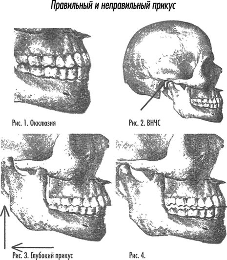 Иллюстрация к книге — Естественное лечение кариеса. Реминерализация и восстановление зубов при помощи питания [i_023.jpg]