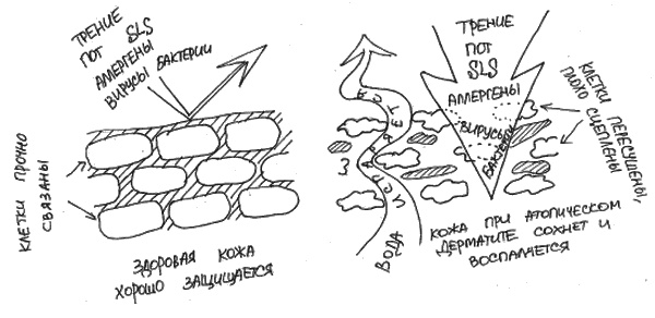 Иллюстрация к книге — Аллергия и как с ней жить. Руководство для всей семьи [i_018.jpg]