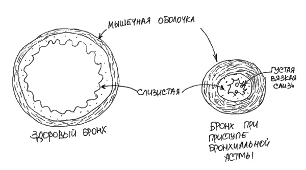 Иллюстрация к книге — Аллергия и как с ней жить. Руководство для всей семьи [i_023.jpg]