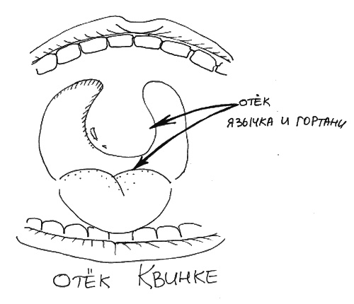 Иллюстрация к книге — Аллергия и как с ней жить. Руководство для всей семьи [i_026.jpg]