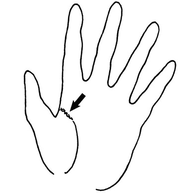 Иллюстрация к книге — Жизнь на ладони. Хиромантия как инструмент самопознания [i_078.jpg]