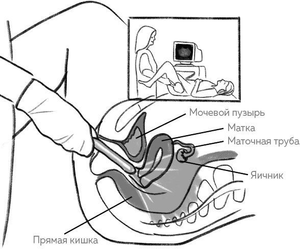 Иллюстрация к книге — Ab Ovo. Путеводитель для будущих мам: об особенностях женской половой системы, зачатии и сохранении беременности [img_19.jpg]