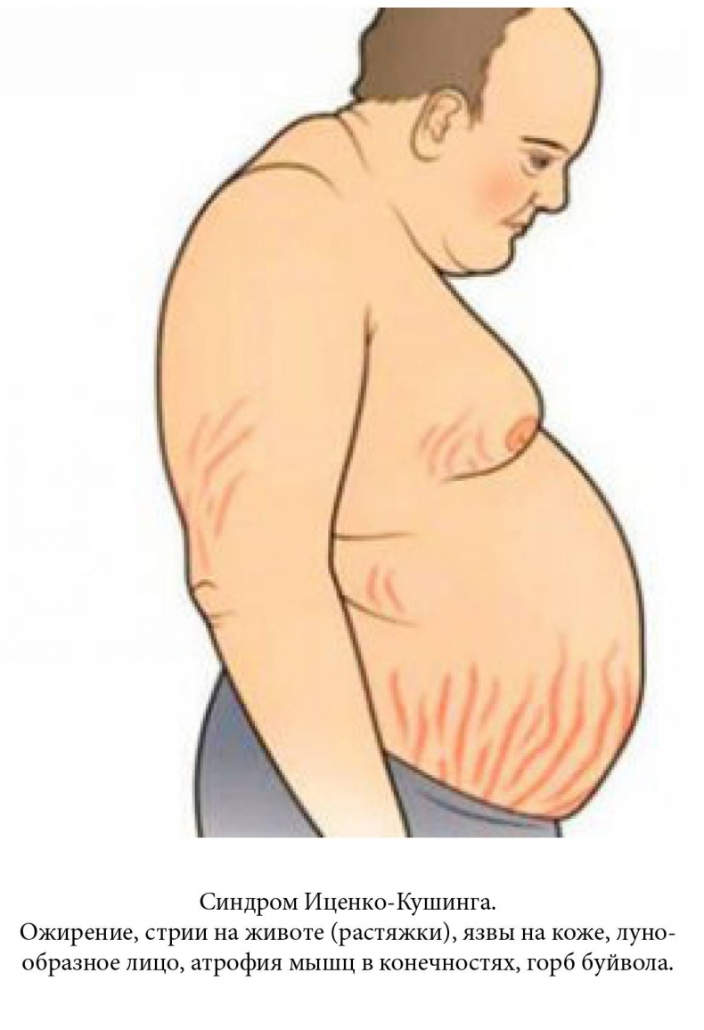 Иллюстрация к книге — Все, что нужно знать об ожирении для эффективного похудения [_5.jpg]