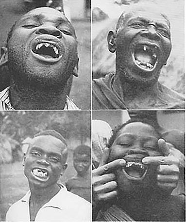 Иллюстрация к книге — Челюсти. Научное исследование о взаимосвязи между зубами, мозгом и кишечником + 40-дневный план питания, который поможет вернуть в норму здоровье ротовой полости и сформировать иммунитет к кариесу [i_006.jpg]