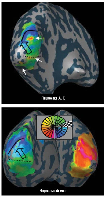 Иллюстрация к книге — Как мы учимся. Почему мозг учится лучше, чем любая машина… пока [i_032.jpg]