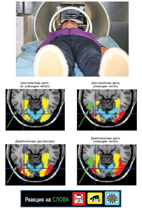 Иллюстрация к книге — Как мы учимся. Почему мозг учится лучше, чем любая машина… пока [i_036.jpg]