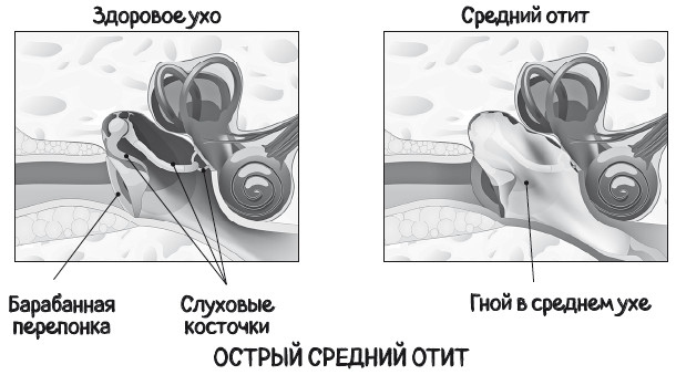 Иллюстрация к книге — Почему болит ухо. Что делать при отитах, снижении слуха и звоне в ушах – правила доказательной медицины [i_011.jpg]