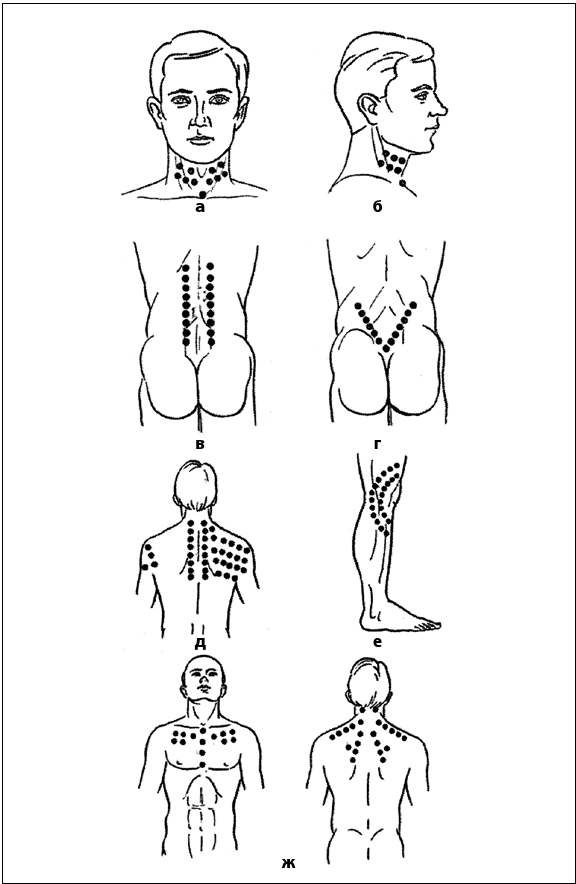 Иллюстрация к книге — Рефлексотерапия. Как восстановить подвижность суставов в домашних условиях [i_014.jpg]