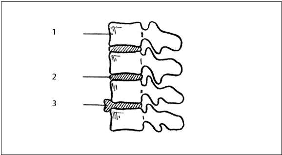 Иллюстрация к книге — Рефлексотерапия. Как восстановить подвижность суставов в домашних условиях [i_040.jpg]