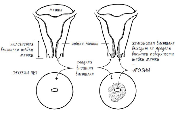 Иллюстрация к книге — Женское здоровье. Без стыда и глупостей [i_002.jpg]