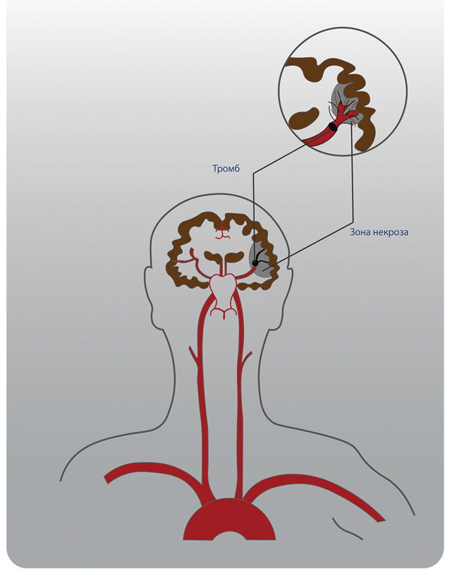 Иллюстрация к книге — Как жить после инфаркта [i_004.jpg]