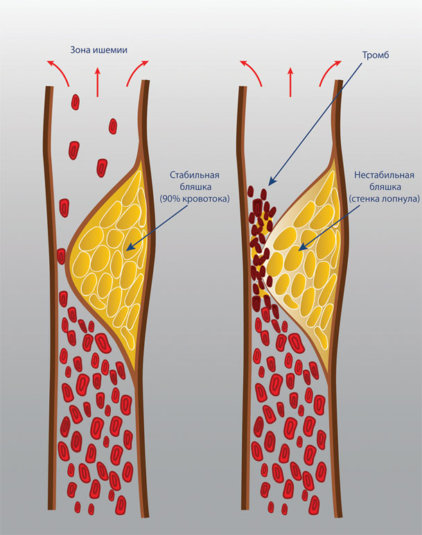 Иллюстрация к книге — Как жить после инфаркта [i_008.jpg]