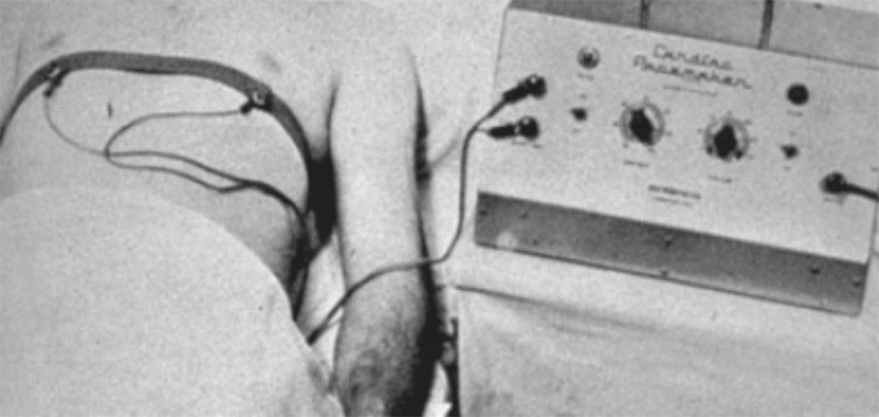 Иллюстрация к книге — Как жить после инфаркта [i_011.jpg]