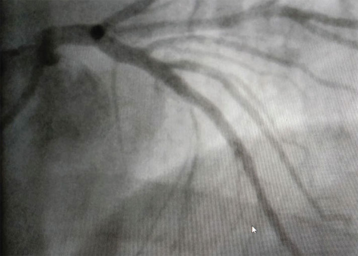 Иллюстрация к книге — Как жить после инфаркта [i_015.jpg]