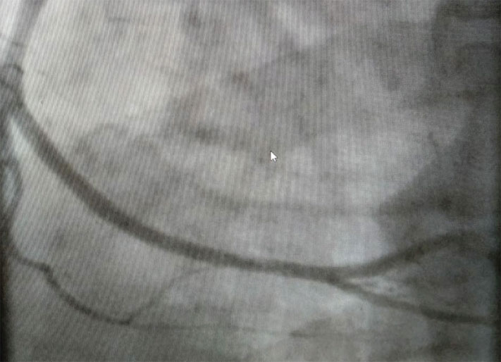 Иллюстрация к книге — Как жить после инфаркта [i_016.jpg]