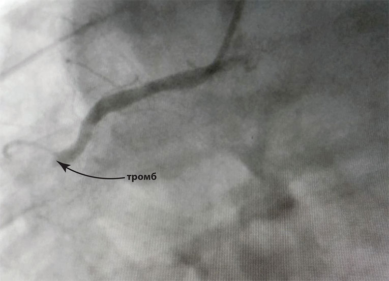 Иллюстрация к книге — Как жить после инфаркта [i_017.jpg]