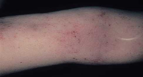 Иллюстрация к книге — Аллергия. Истинные причины. Лечение [i_014.jpg]