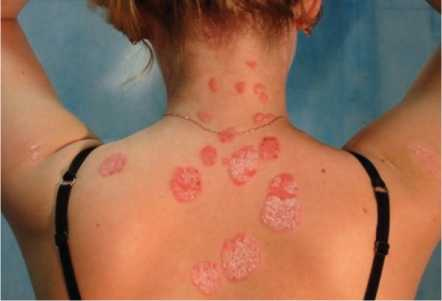 Иллюстрация к книге — Аллергия. Истинные причины. Лечение [i_016.jpg]