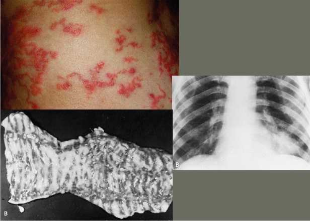 Иллюстрация к книге — Аллергия. Истинные причины. Лечение [i_021.jpg]