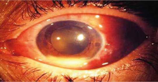 Иллюстрация к книге — Аллергия. Истинные причины. Лечение [i_025.jpg]