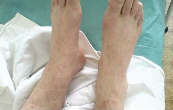 Иллюстрация к книге — Аллергия. Истинные причины. Лечение [i_029.jpg]