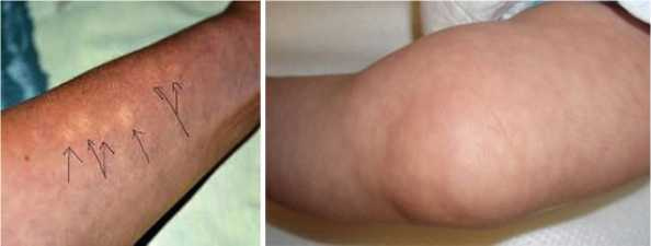 Иллюстрация к книге — Аллергия. Истинные причины. Лечение [i_031.jpg]