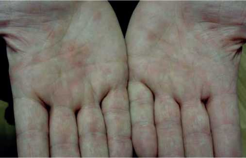 Иллюстрация к книге — Аллергия. Истинные причины. Лечение [i_037.jpg]