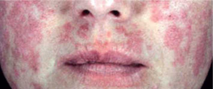 Иллюстрация к книге — Аллергия. Истинные причины. Лечение [i_038.jpg]