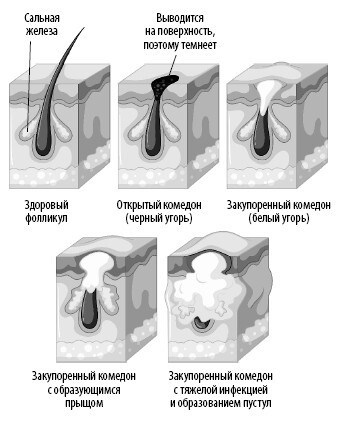 Иллюстрация к книге — Взламывая анатомию [image46.jpg]