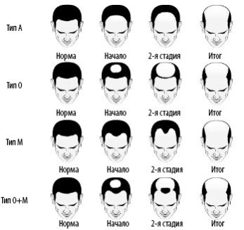 Иллюстрация к книге — Взламывая анатомию [image53.jpg]